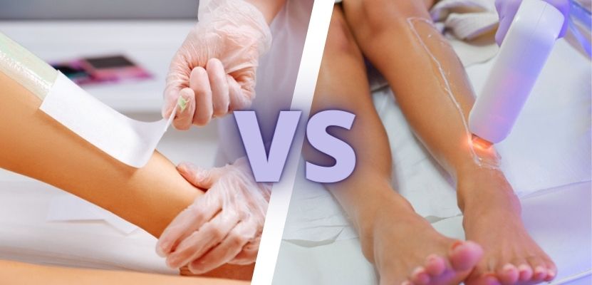 Laser Hair Removal vs Waxing: Which Is Better for Me? - Nurse Practitioners of Florida